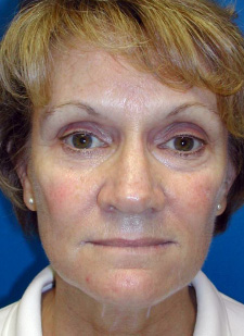 350-3B - Vargas Face and Skin Center