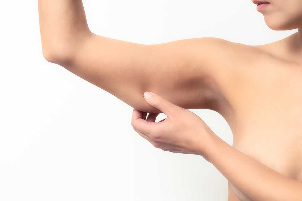 Fight the Bat Wing: How Laser Lipo Can Slim Your Arms - Vargas