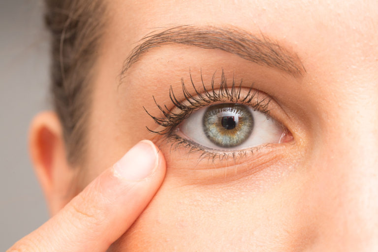 Everything You Need to Know About Sunken Eyes