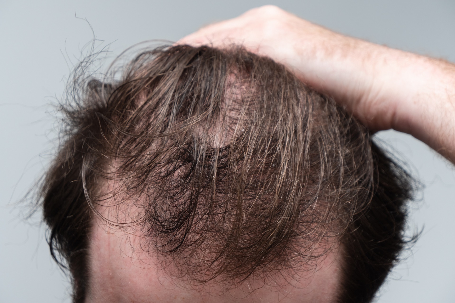 Let s Debunk Some Common Hair Loss Myths 