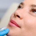 Lip Lift Vs. Lip Fillers: Weighing The Pros And Cons