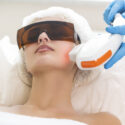 Benefits And Side Effects Of Facial Laser Treatments